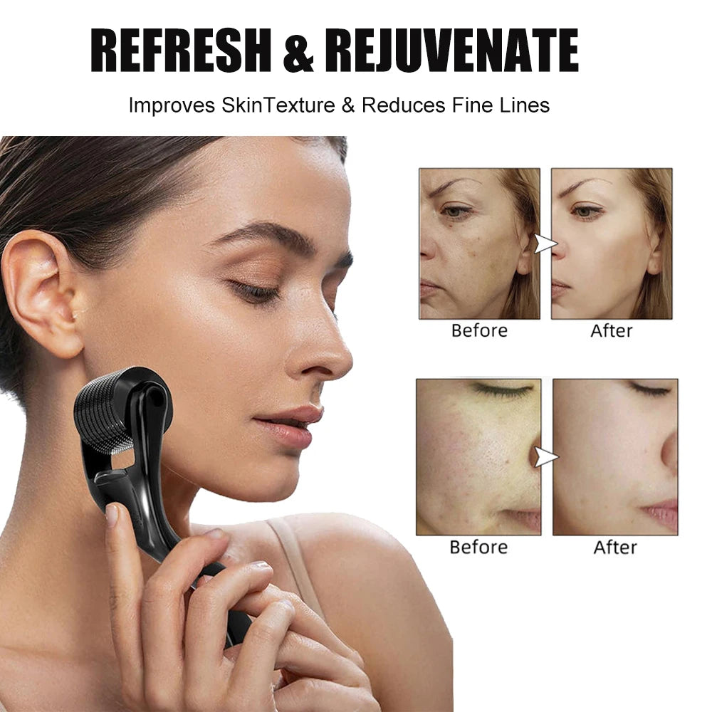 Derma Roller 540 Needles Skin Renewal